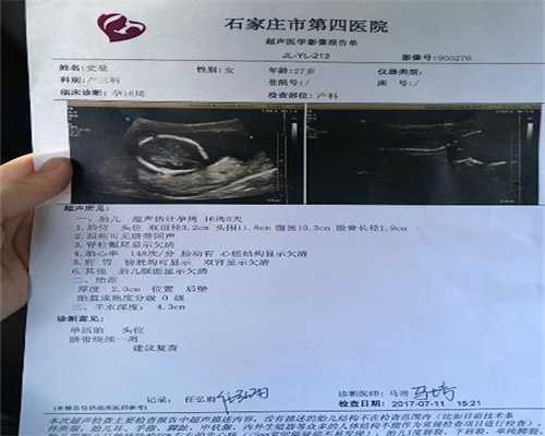 武汉人工受孕哪个医院好：老婆五年生四胎，女