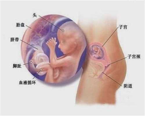 孕期反应大，别担心，是宝宝身体健康的表现