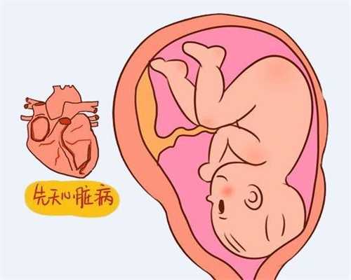 孕期文胸太紧勒怎么办，对胎儿有影响吗