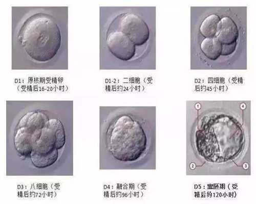 武汉人工受孕医院,只要您在怀孕期间进行健身运