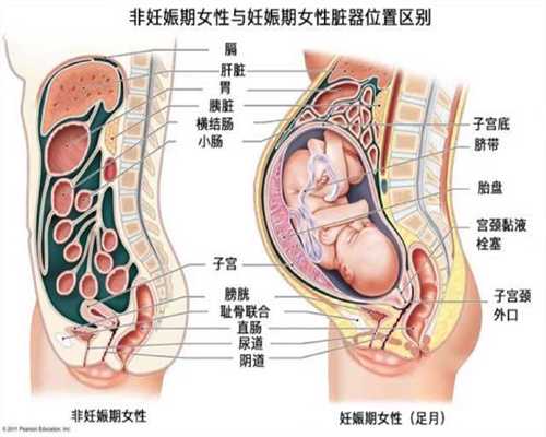 武汉代妈招聘电话,孕前积极健康调理，轻松怀孕